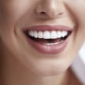 What cosmetic dentistry can do for you?