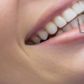 What is an Initial Dental Exam? A Comprehensive Guide