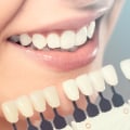 What are the risks associated with cosmetic dentistry?