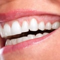 Can a regular dentist do gum contouring?