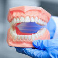 The Risks of Not Visiting the Dentist: What You Need to Know