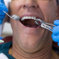 What is the most complicated dental procedure?