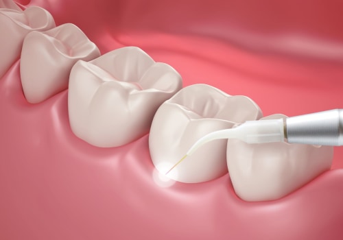 Can i get tooth lengthening using a cosmetic dental procedure?