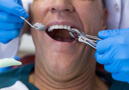 What is the most complicated dental procedure?