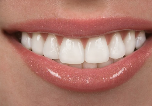 Are there any special instructions for caring for my teeth after a cosmetic dental procedure?