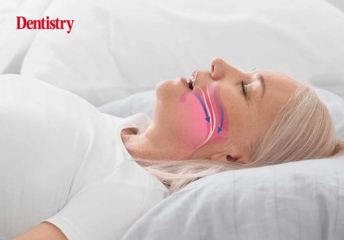 Are there any treatments available for sleep apnea or snoring problems related to the mouth or jaw structure?