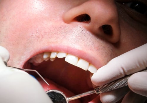 What is the Cost of a Dental Checkup? An Expert's Guide